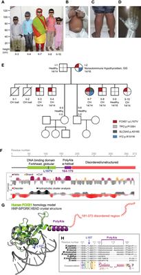 The length of FOXE1 polyalanine tract in congenital hypothyroidism: Evidence for a pathogenic role from familial, molecular and cohort studies